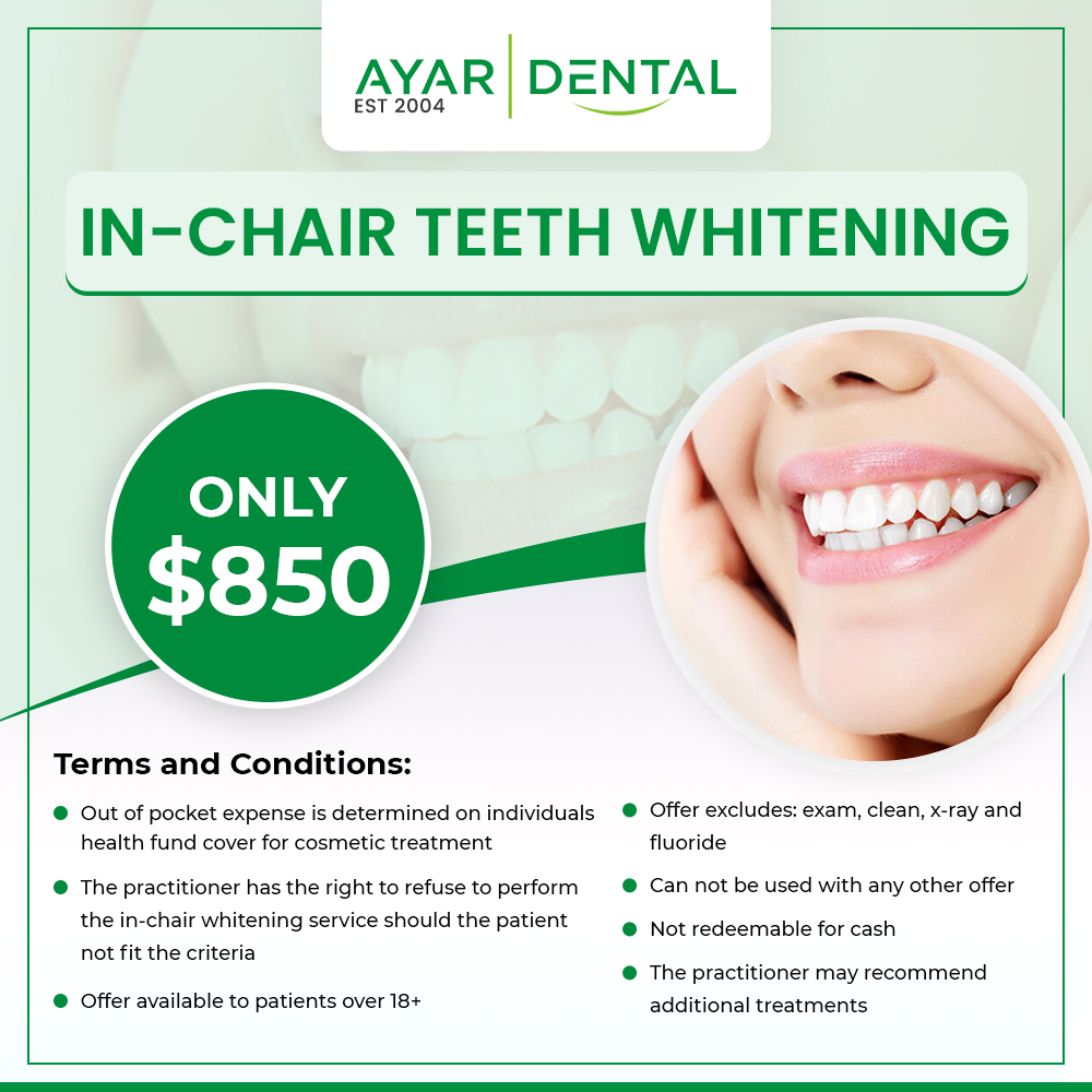 In Chair Teeth Whitening