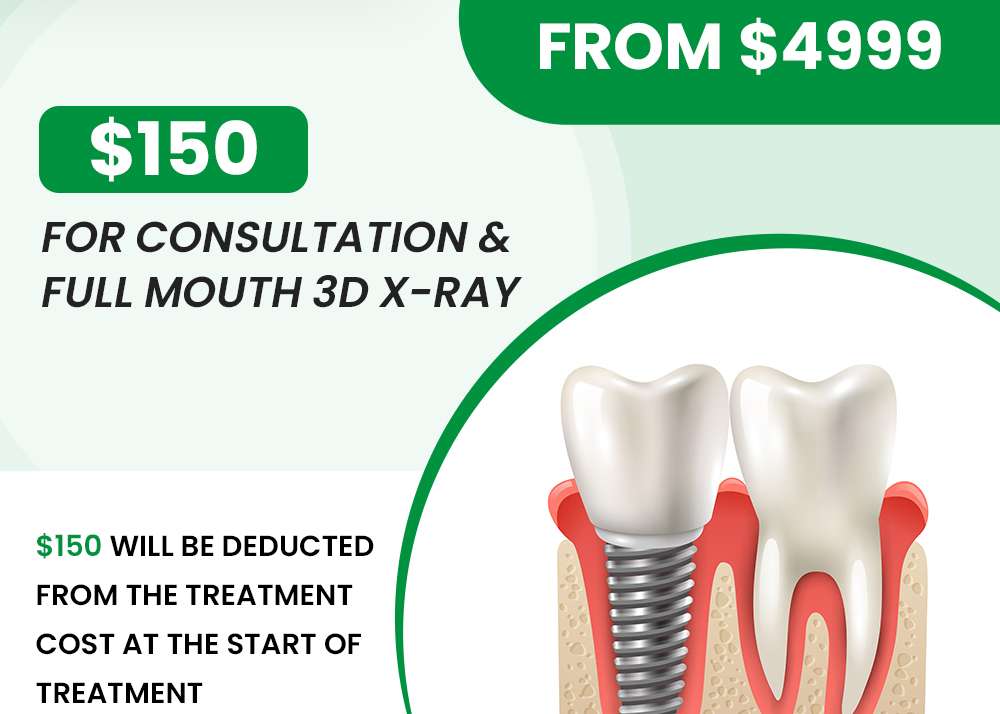 Single Implant from $4999
