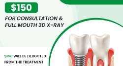 Single Implant from $4999