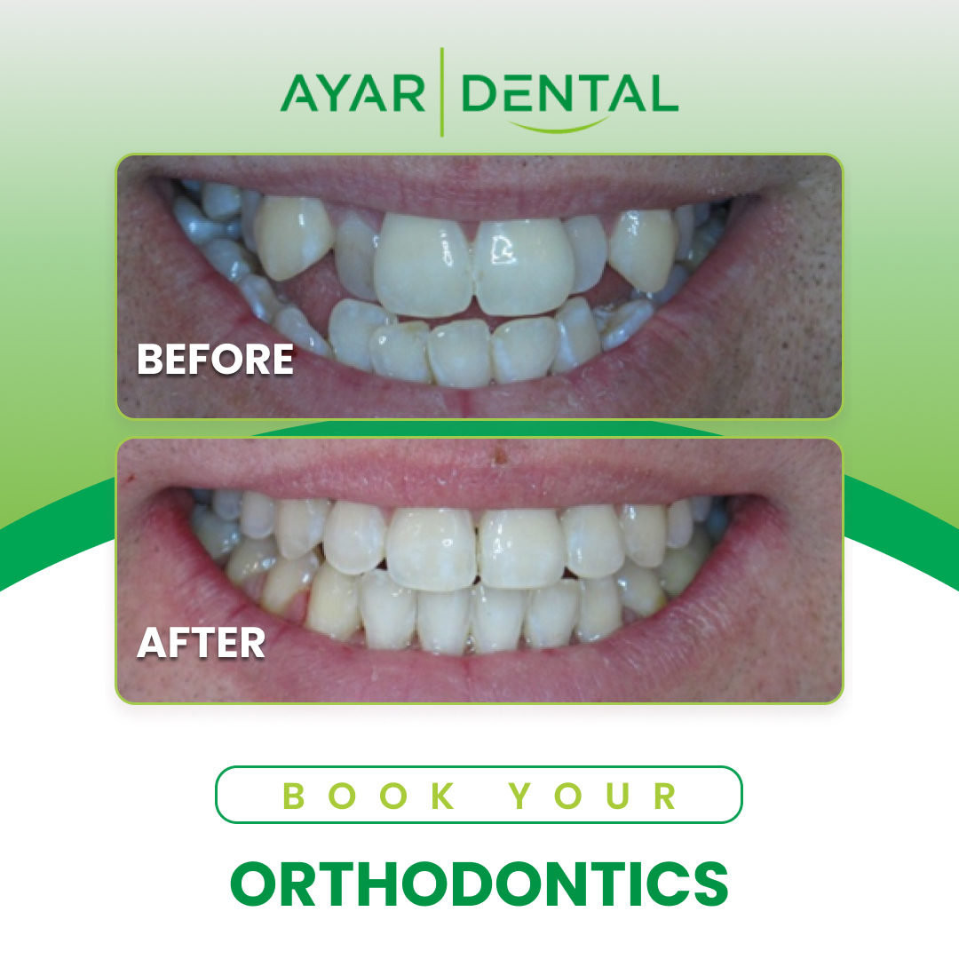 27 Orthodontic Treatment Options