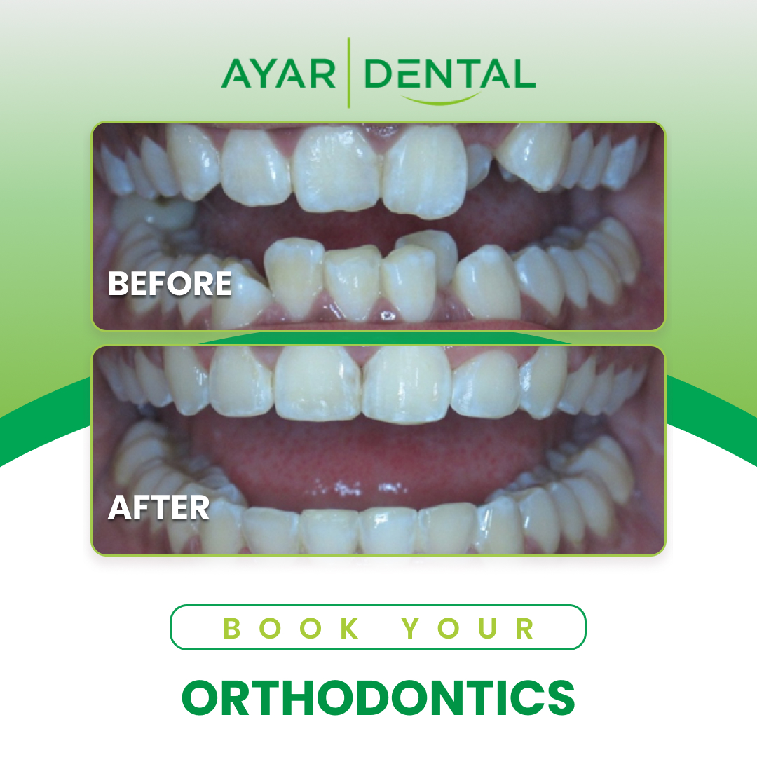 32 Orthodontics (Braces & Invisalign)