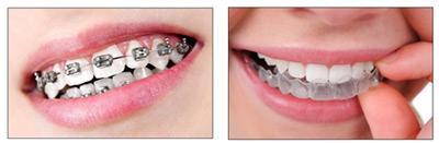 image2-1 Why Orthodontics is Important