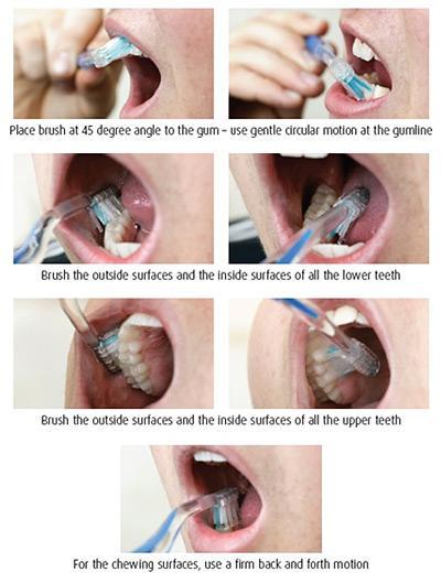 image4-1 The Importance of Oral Hygiene